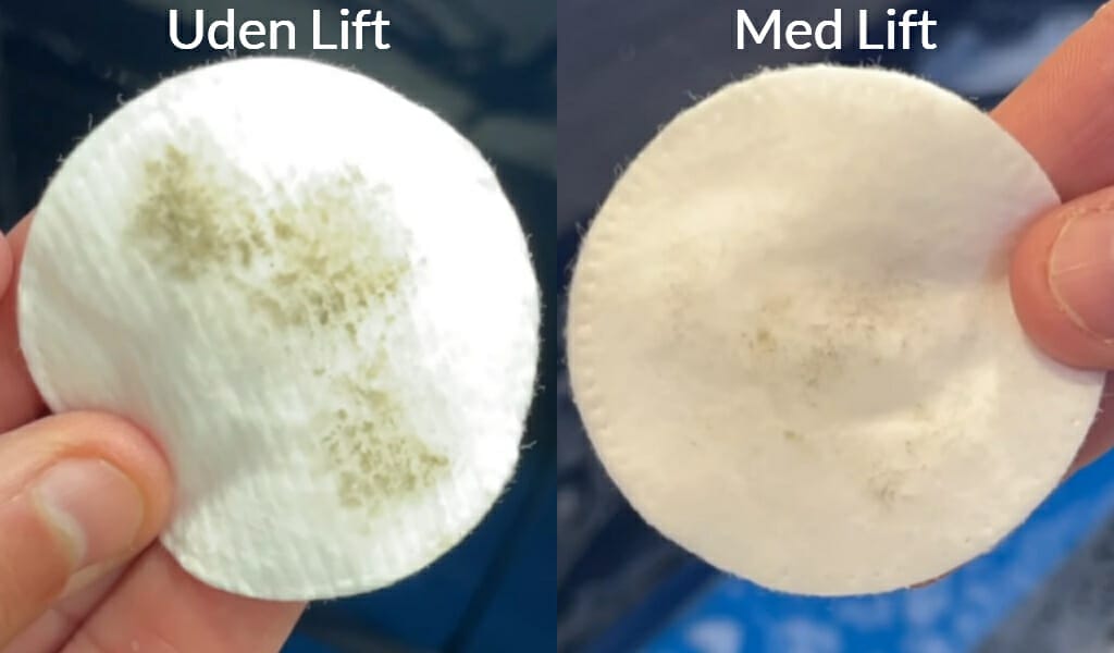 før efter billede af Lift før efter billede af Lift